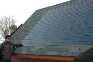 shingles