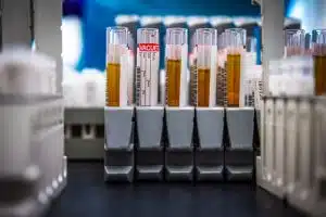 urine-sample